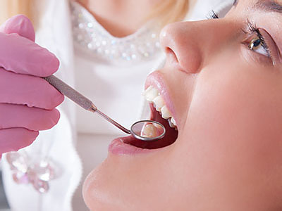 Purely Smiles Dental | Extractions, Dental Fillings and Laser Dentistry